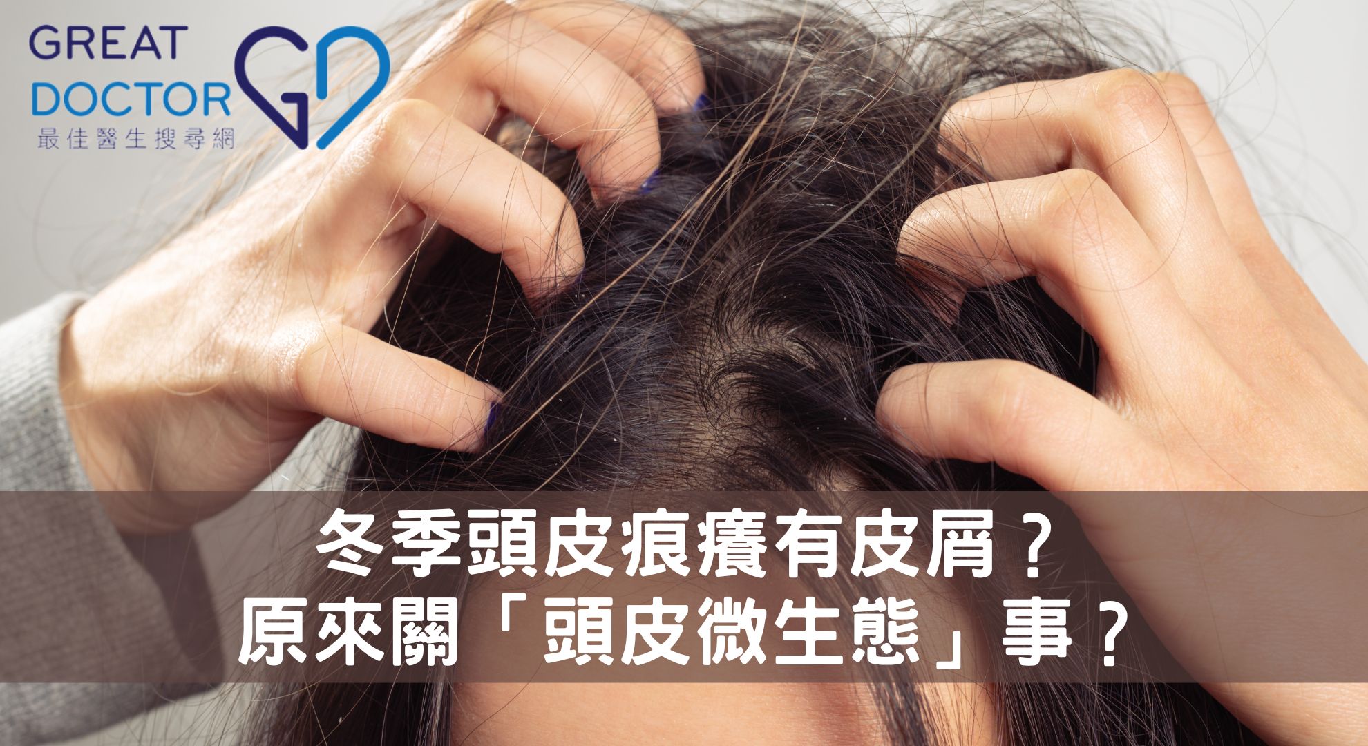 冬季頭皮痕癢有皮屑？  原來關「頭皮微生態」事？
