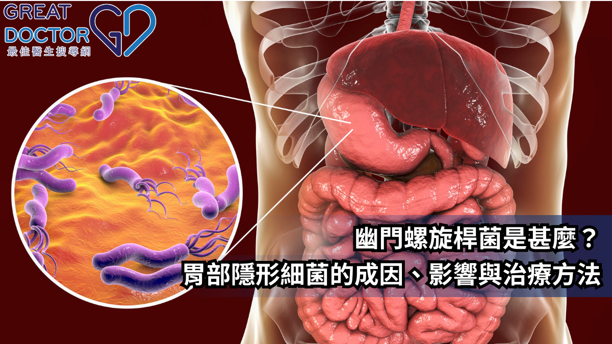 幽門螺旋桿菌是甚麼？胃部隱形細菌的成因、影響與治療方法