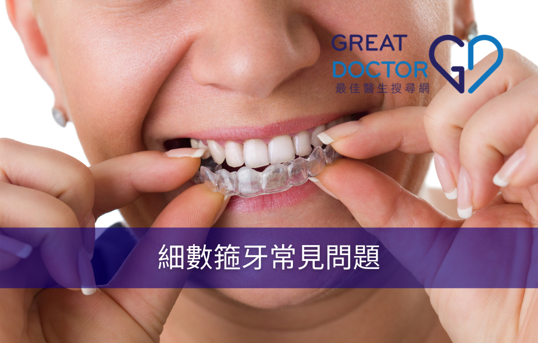 細數箍牙常見問題