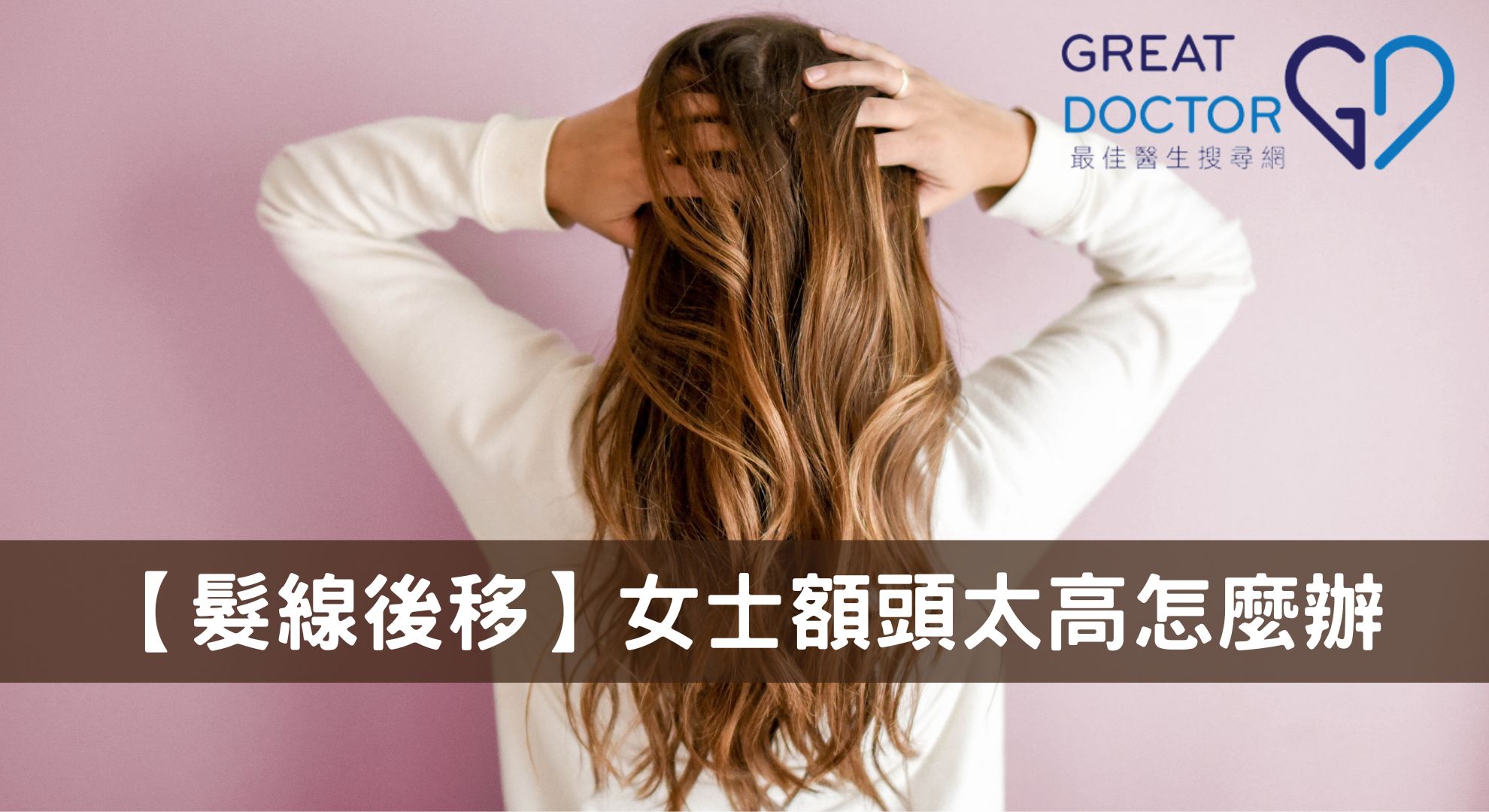 【髮線後移】女士額頭太高怎麼辦