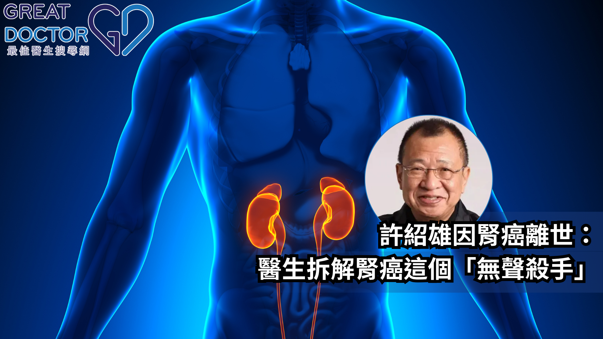 【許紹雄因腎癌離世：醫生拆解「無聲殺手」-腎癌】