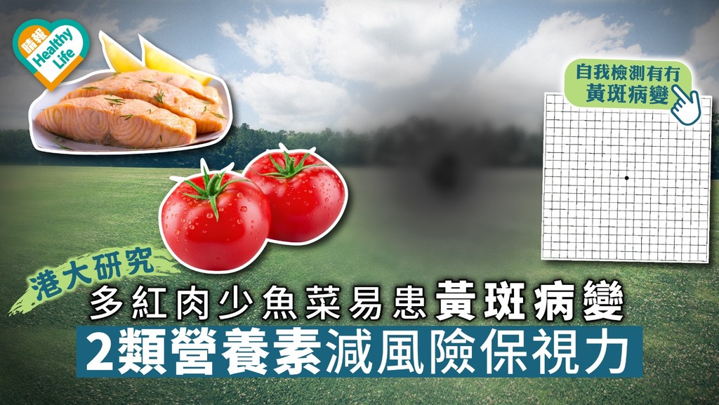 【港大研究】多紅肉少魚菜易患黃斑病變2大營養素減風險保視力