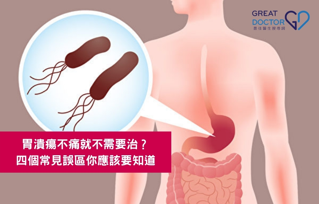 胃潰瘍不痛就不需要治？四個常見誤區你應該要知道