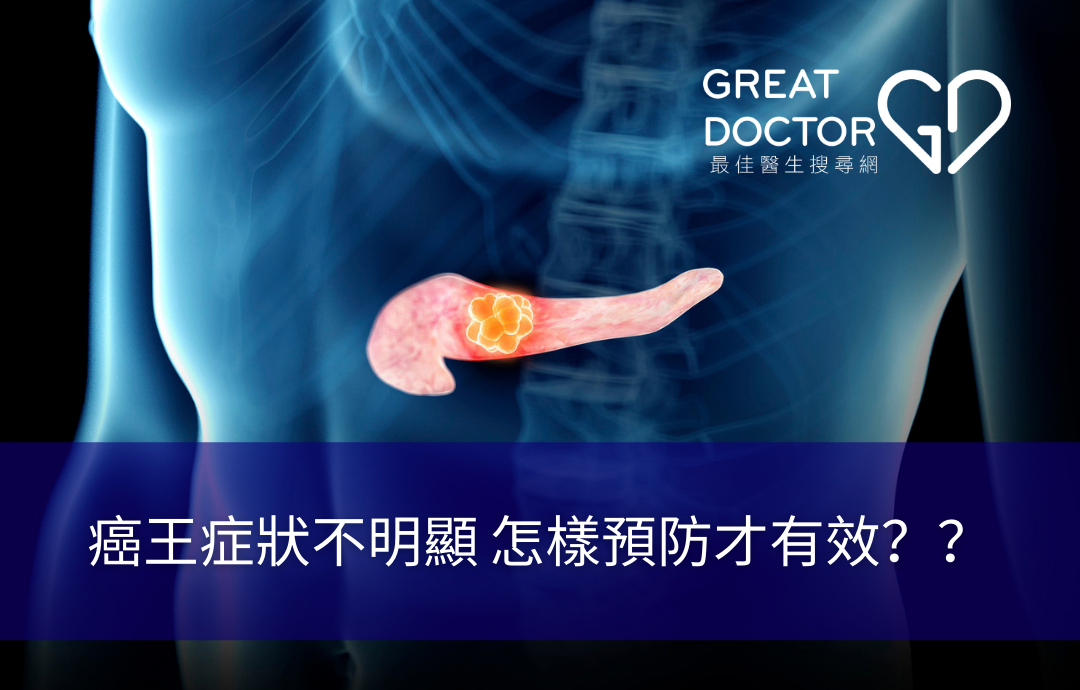 癌王症狀不明顯 怎樣預防才有效？