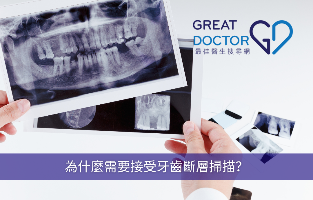 為什麼需要接受牙齒斷層掃描？