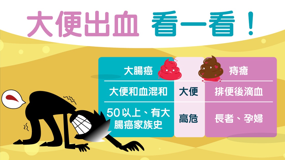 大便出血痔瘡或大腸癌？你懂大腸癌與痔瘡3大分別嗎？