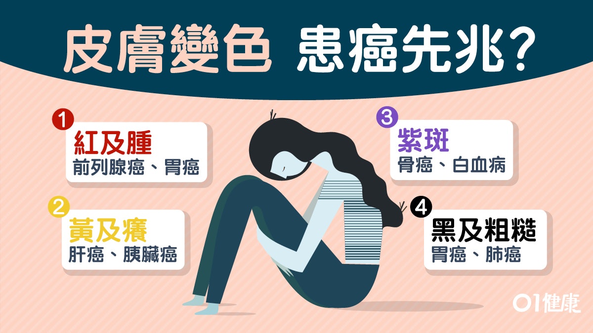 【癌症】皮膚發黑或是肺癌徵兆　4種皮膚顏色可能患癌了？