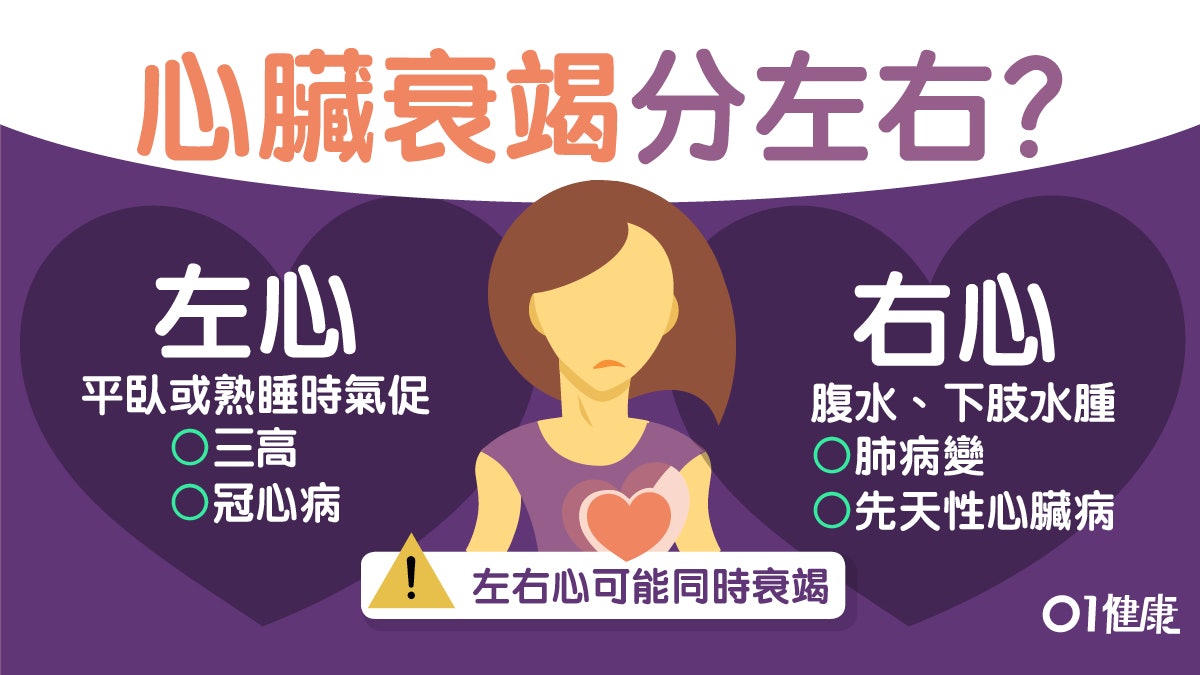 【心臟病】氣喘肚脹難集中可能心臟衰竭？左右症狀不同程度分4級