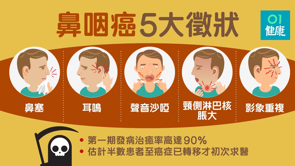 【鼻咽癌】早期病徵與鼻炎相似不易察覺　淋巴核腫脹已病情嚴重
