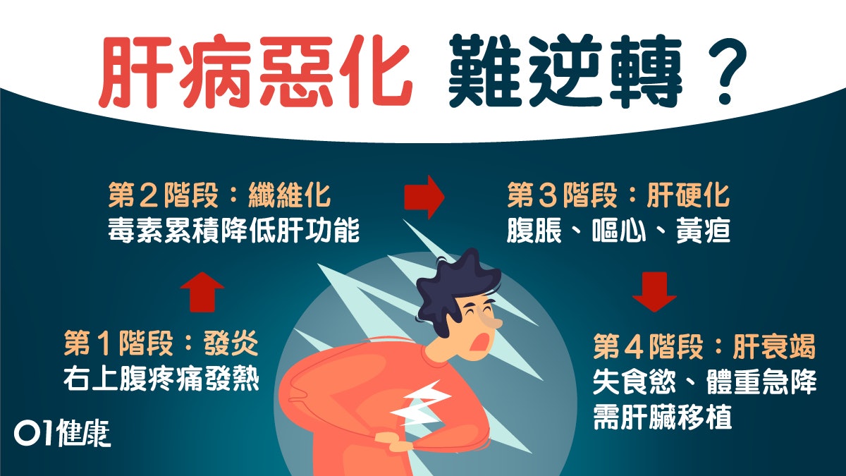 肝病必經4階段纖維化可自癒？腳腫肚脹肝硬化徵兆