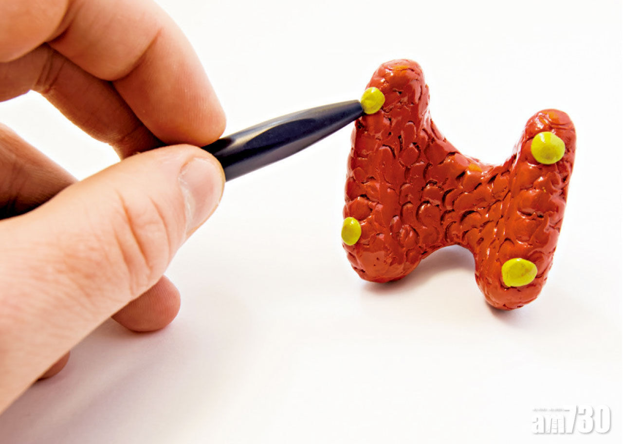 副甲狀腺亢奮症致血鈣升高