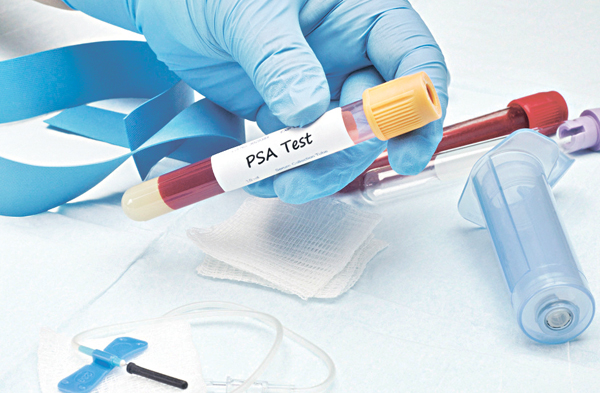 關注年輕前列腺癌 精準診斷更易控病