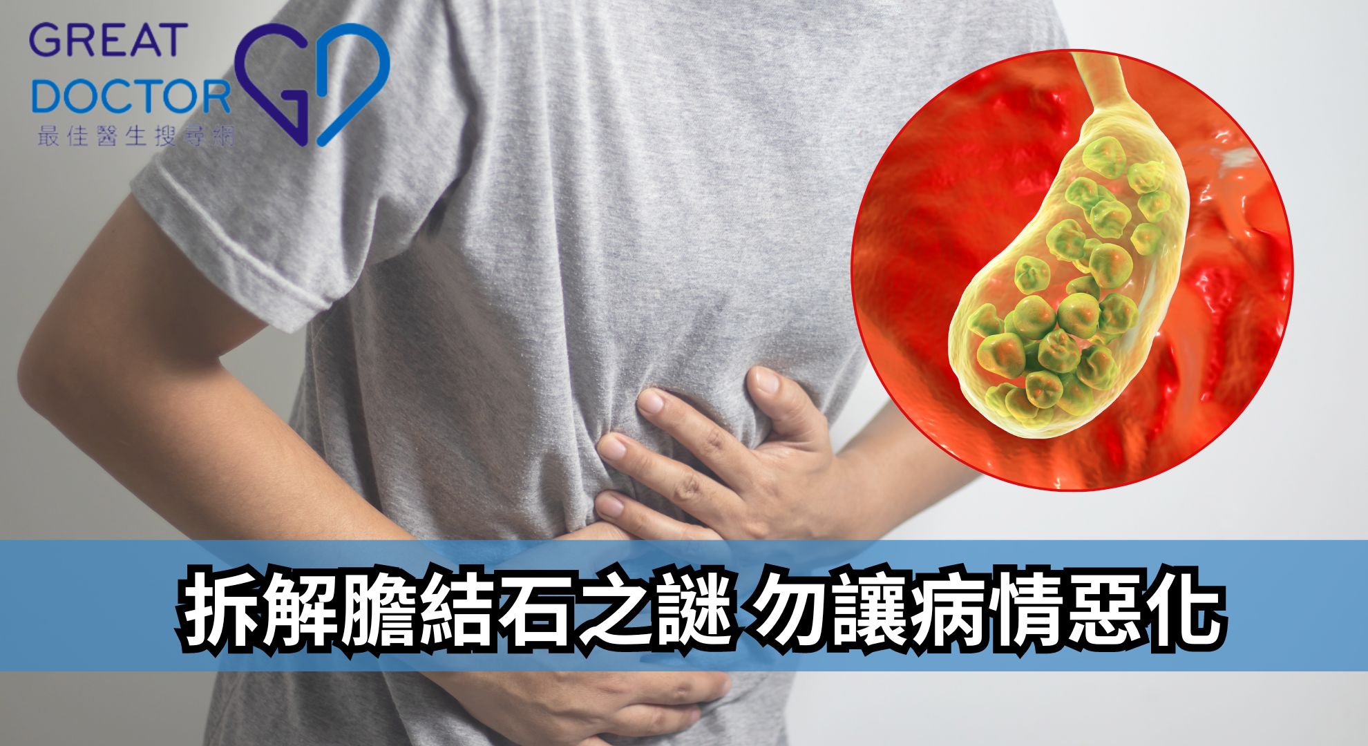 【拆解膽結石之謎 勿讓病情惡化】