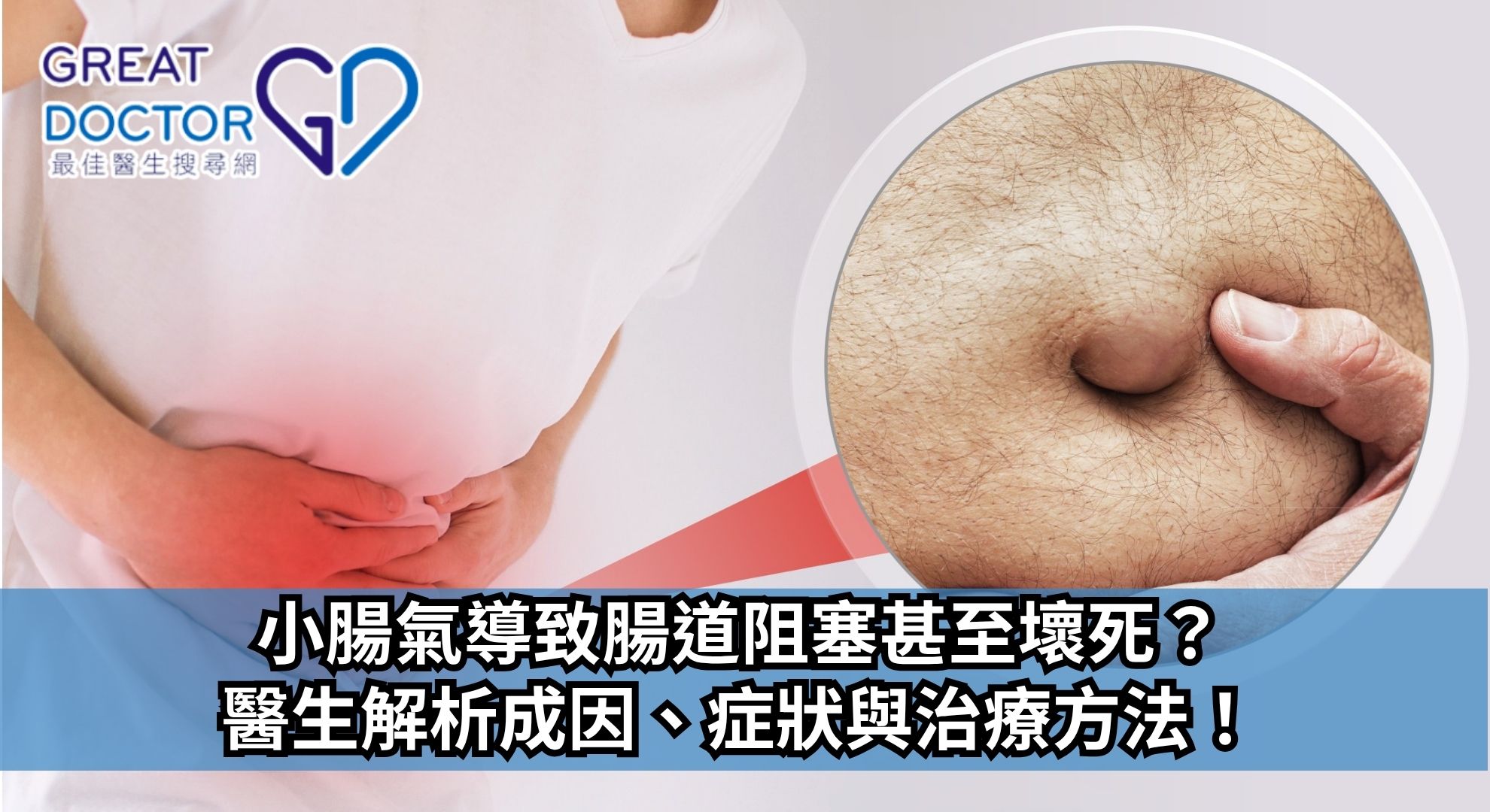 小腸氣導致腸道阻塞甚至壞死？醫生解析成因、症狀與治療方法！