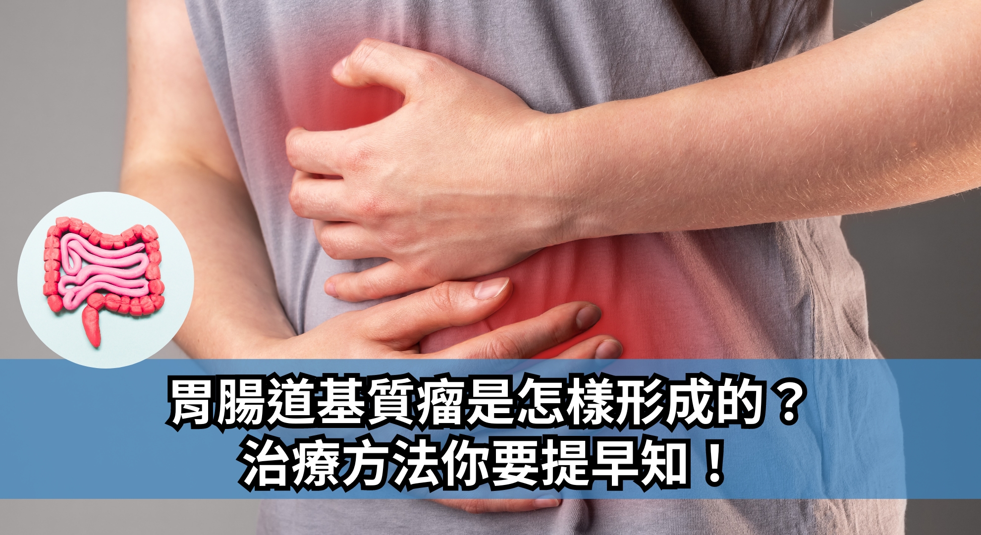 胃腸道基質瘤是怎樣形成的？治療方法你要提早知！