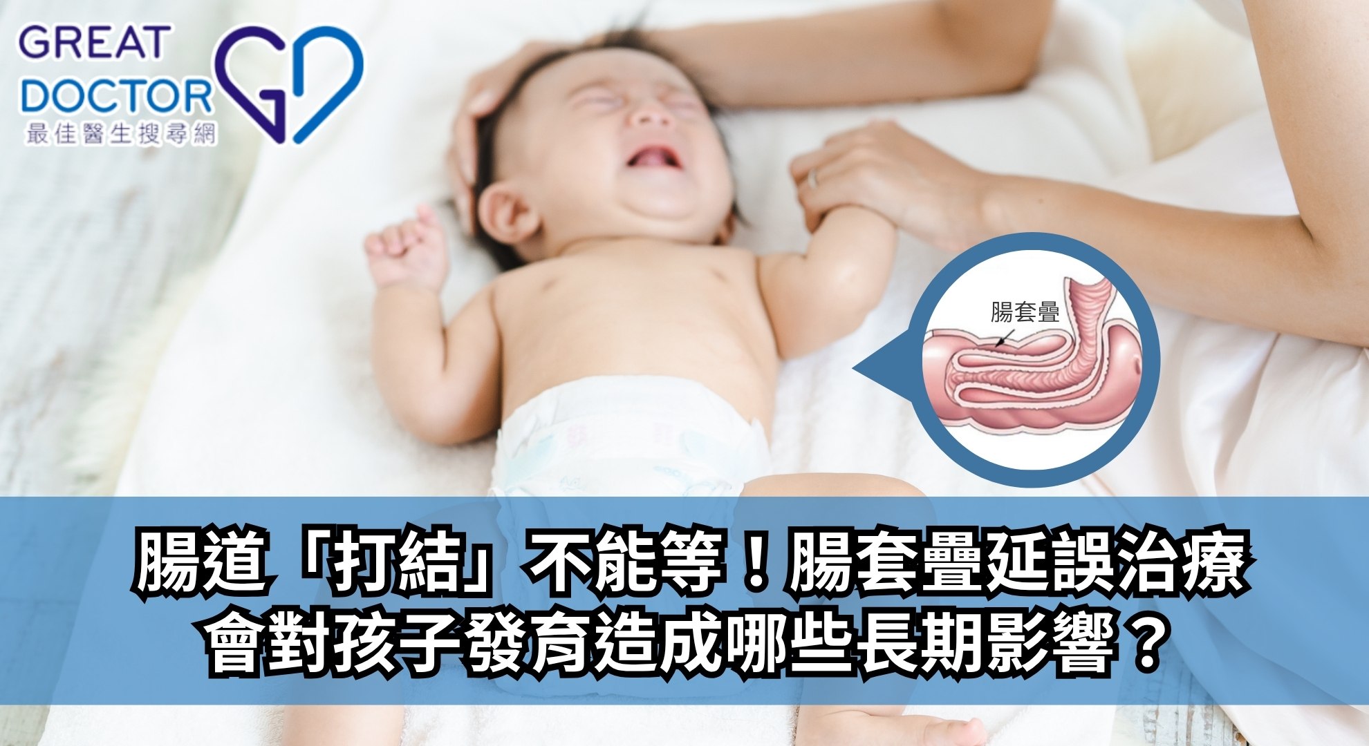 腸道「打結」不能等！腸套疊延誤治療會對孩子發育造成哪些長期影響？