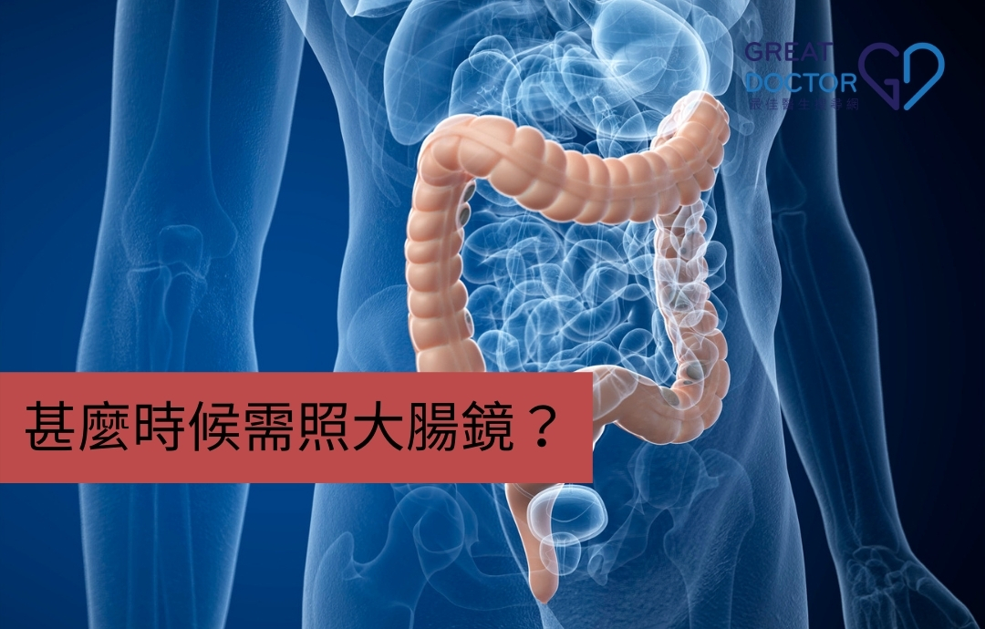 甚麼時候需照大腸鏡？