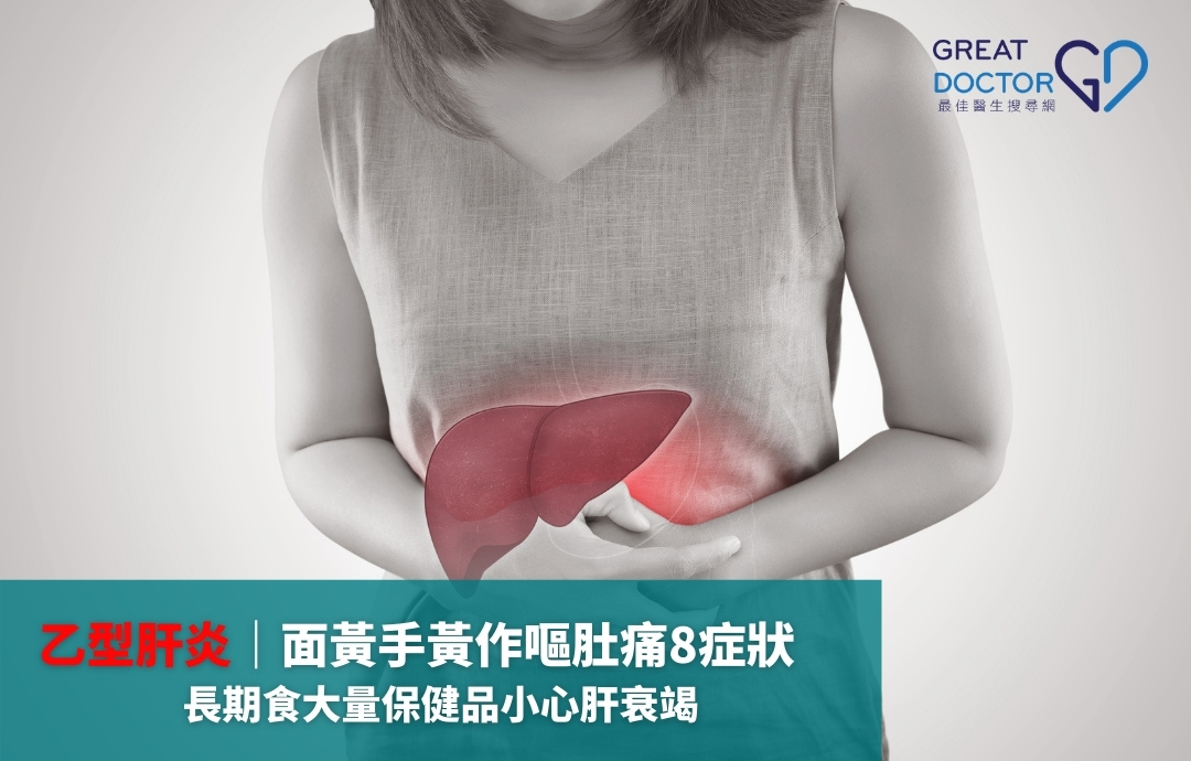 乙型肝炎｜面黃手黃作嘔肚痛8症狀　長期食大量保健品小心肝衰竭