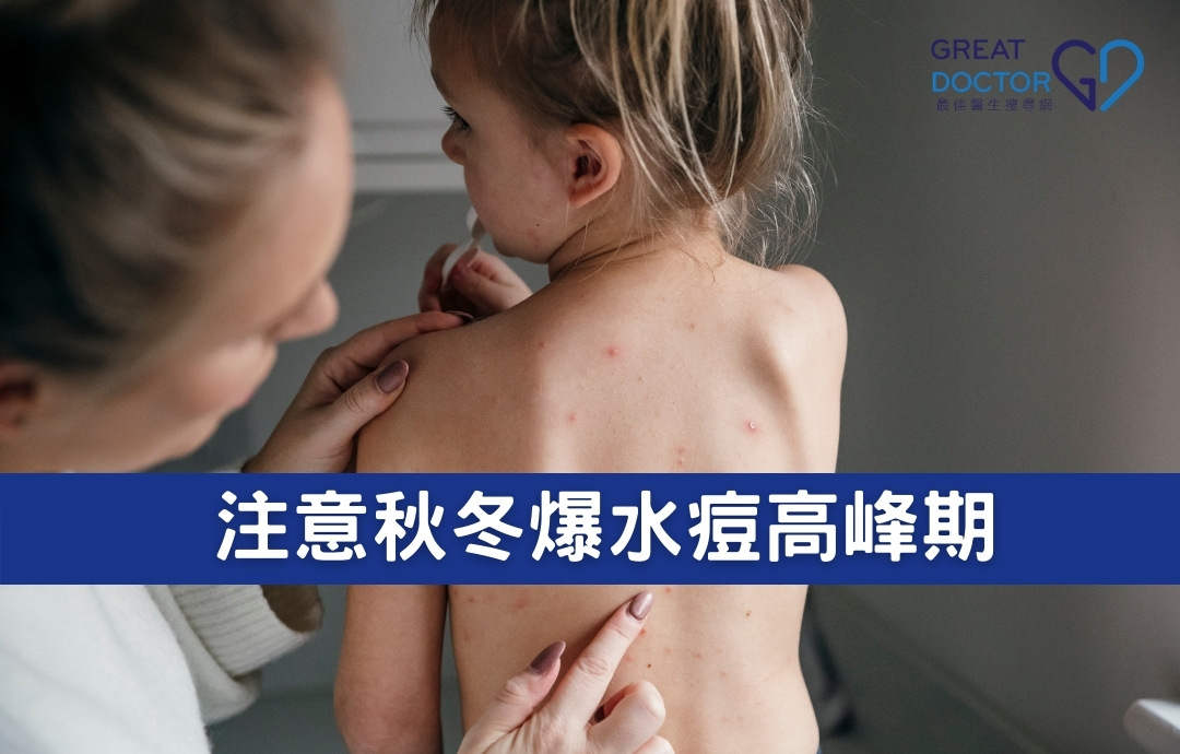 注意秋冬爆水痘高峰期