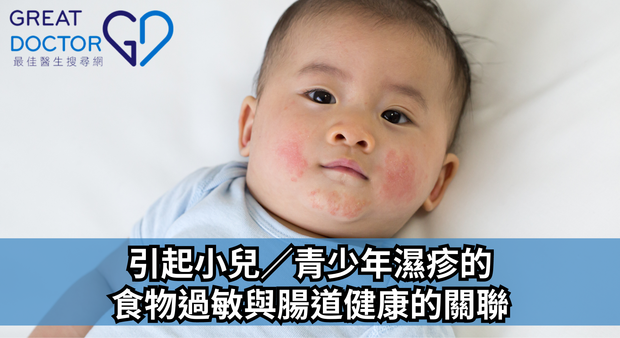 引起小兒／青少年濕疹的食物過敏與腸道健康的關聯