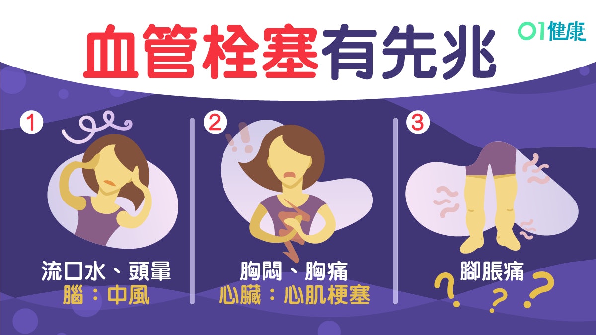 心臟病或因血栓堵塞3個部位所致　留意腳腫氣喘6大症狀！