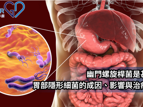 幽門螺旋桿菌是甚麼？胃部隱形細菌的成因、影響與治療方法
