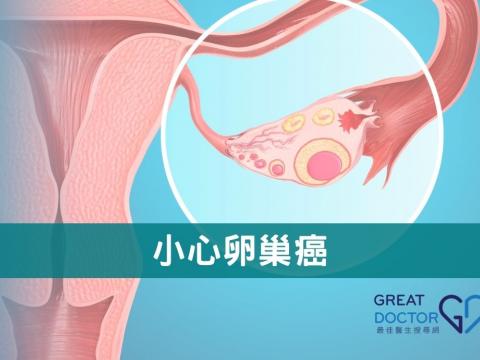 小心卵巢癌