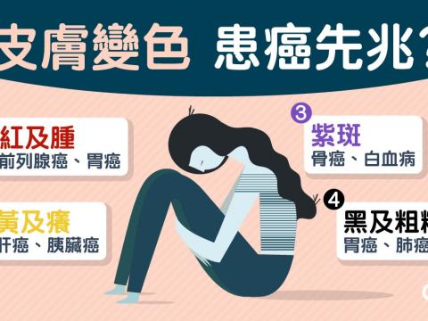 【癌症】皮膚發黑或是肺癌徵兆　4種皮膚顏色可能患癌了？