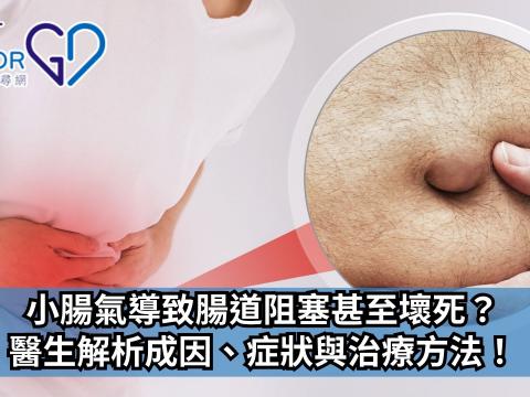 小腸氣導致腸道阻塞甚至壞死？醫生解析成因、症狀與治療方法！