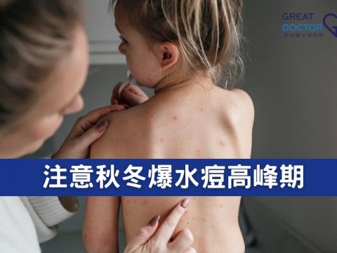 注意秋冬爆水痘高峰期